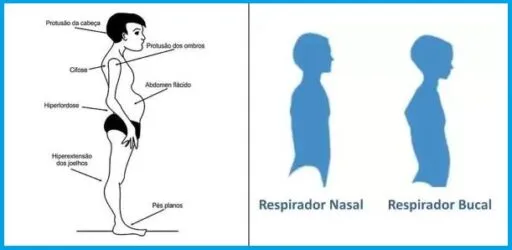 respirador oral
