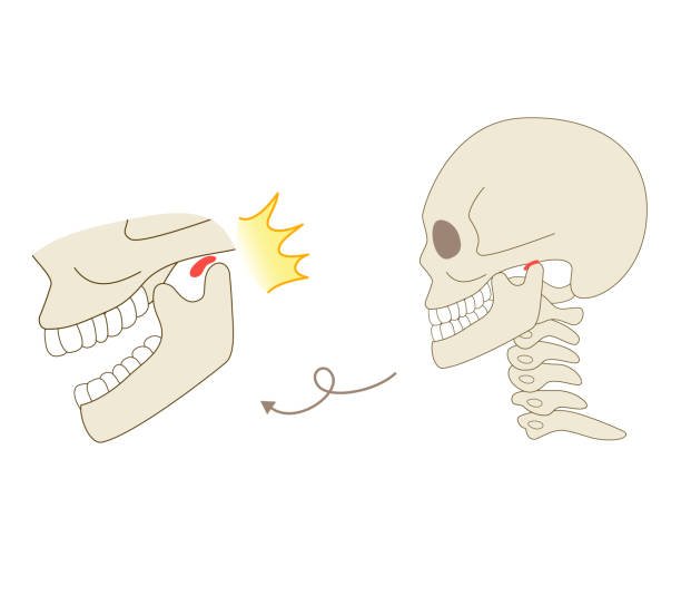 ATM (articulação temporomandibular)